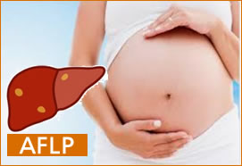 CASE REPORT: Postpartum Acute Fatty Liver of Pregnancy (772)