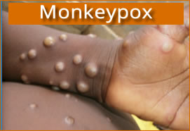 Monkeypox: A Detailed Review (948)
